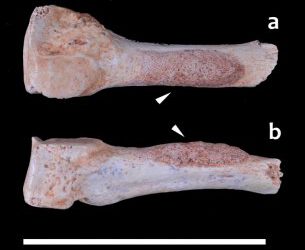 Homo antecessor tenía lesiones de deportista de élite